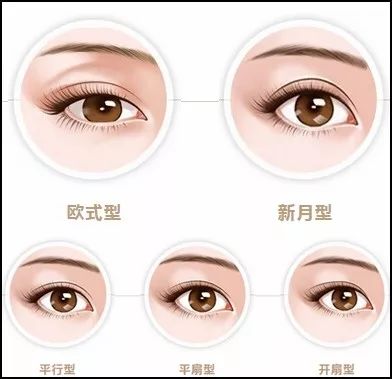 双眼皮手术后的潜在后遗症及其预防措施
