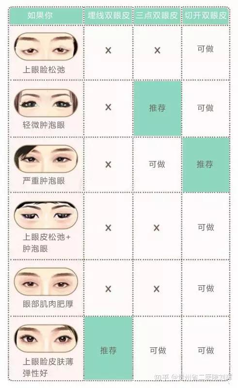 双眼皮手术，对眼睛的影响及其风险评估